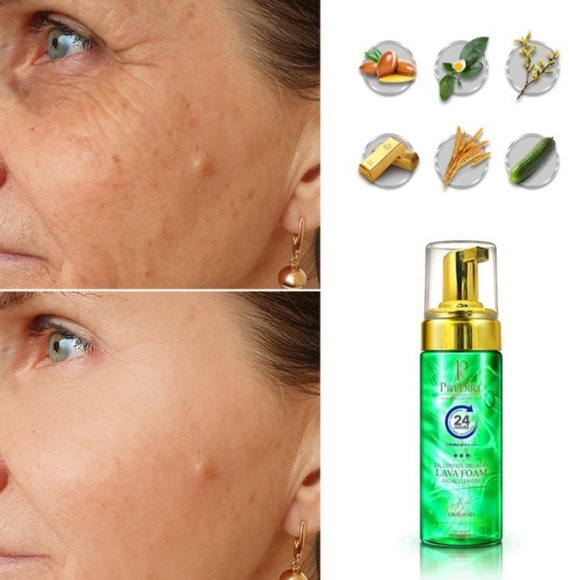 NEW-Oil Control Teal Lava Foam Facial Cleanser W/Collagen & StemCell Technology - Picture 2 of 5